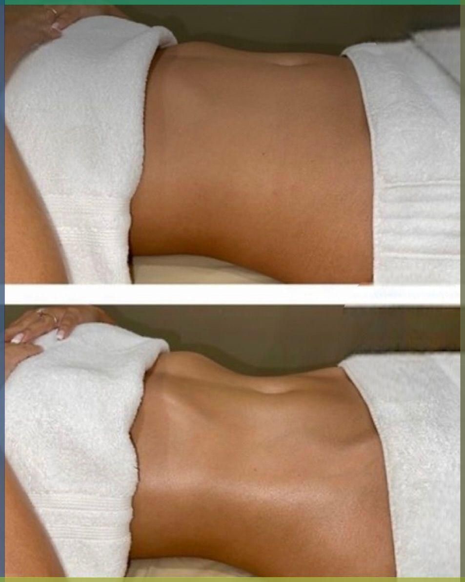 Razmazite svoje tijelo uz raznovrsne tretmane u Beauty Studiju Neaa koji obuhvataju anticelulitnu masažu, limfnu drenažu, termo deku i detoks čaj!