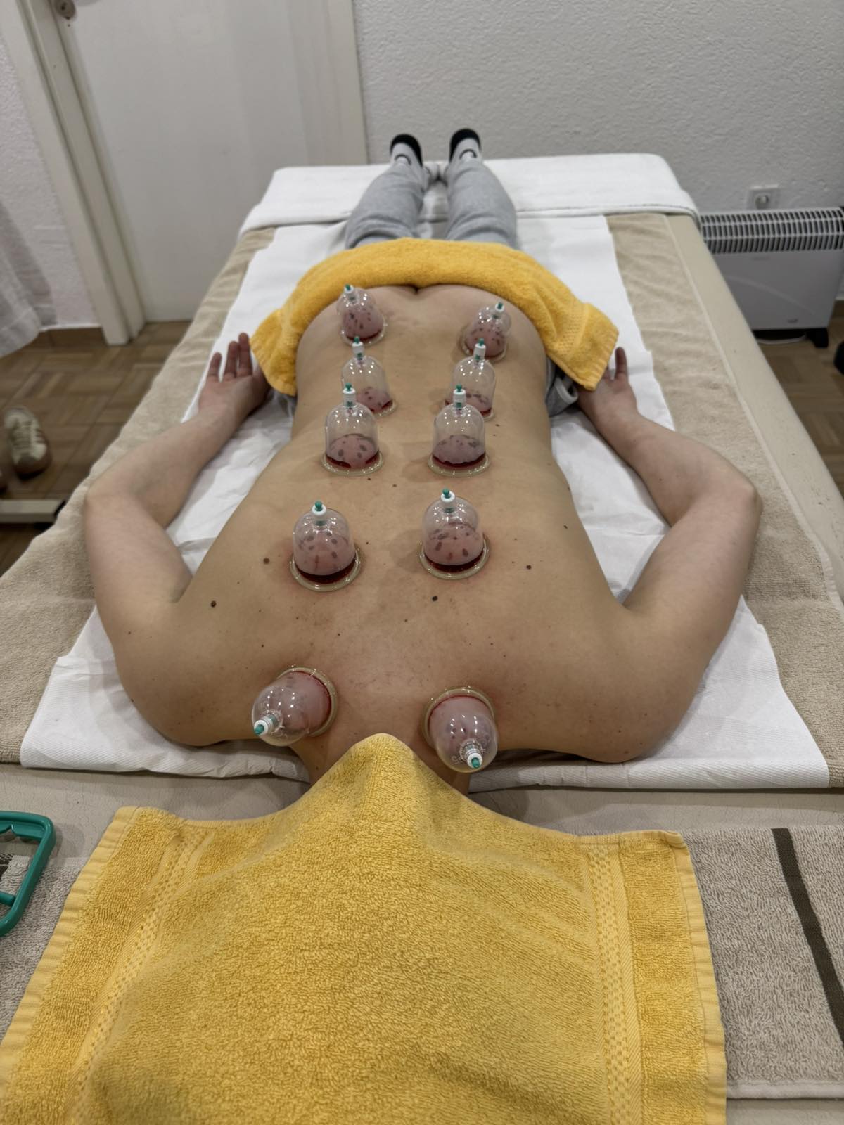 Sanya Beauty Studio – hidžama kao tradicionalni tretman za detoksikaciju, bolju cirkulaciju i jačanje imuniteta!