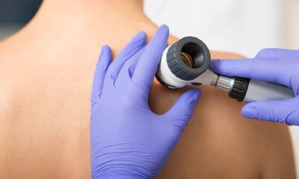 Posvetite pažnju zdravlju svoje kože – obavite stručni dermatološki pregled u Našoj klinici i napravite važan korak ka pravovremenom otkrivanju promjena na koži!
