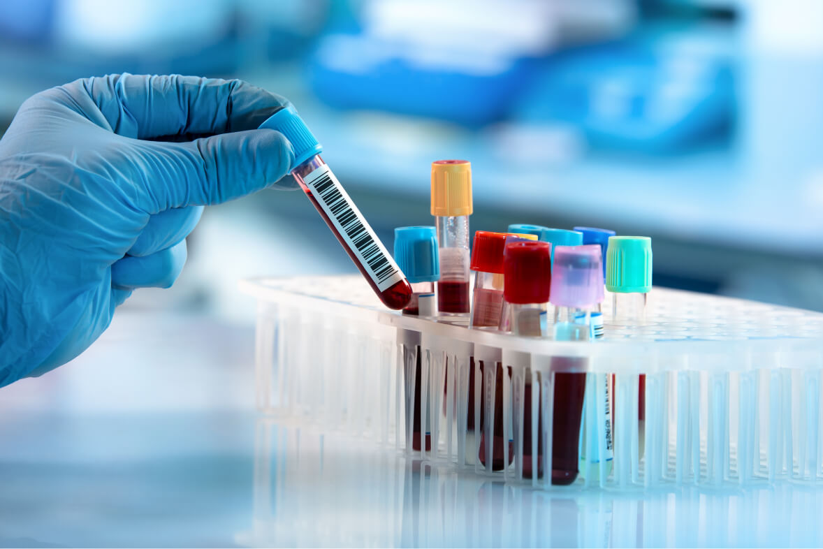 Precizna dijagnostika uz EXTRA ili PREMIUM paket laboratorijskih pretraga , Vaša su garancija za zdravlje u Plavoj Poliklinici!