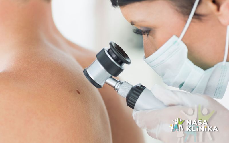 Posvetite pažnju zdravlju svoje kože – obavite stručni dermatološki pregled u Našoj klinici i napravite važan korak ka pravovremenom otkrivanju promjena na koži!