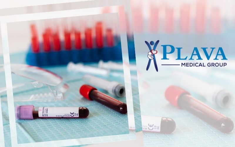 Laboratorijske pretrage u Plavoj Poliklinici – visok standard kvaliteta u laboratorijskoj dijagnostici za pouzdano praćenje i unapređenje zdravlja!