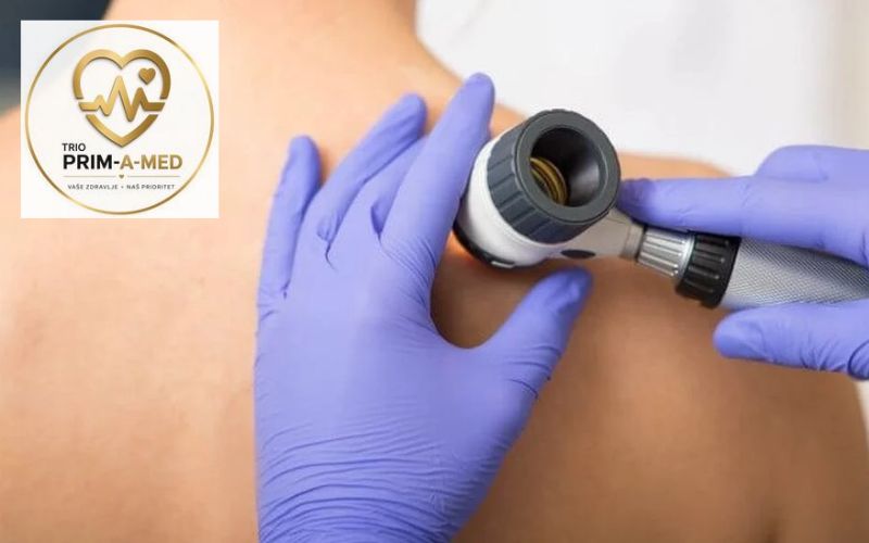 Zdravlje kože počinje stručnom procjenom – dermoskopski i dermatološki pregled u Poliklinici TRIO Prim-A-Med za detaljan uvid u stanje kože!