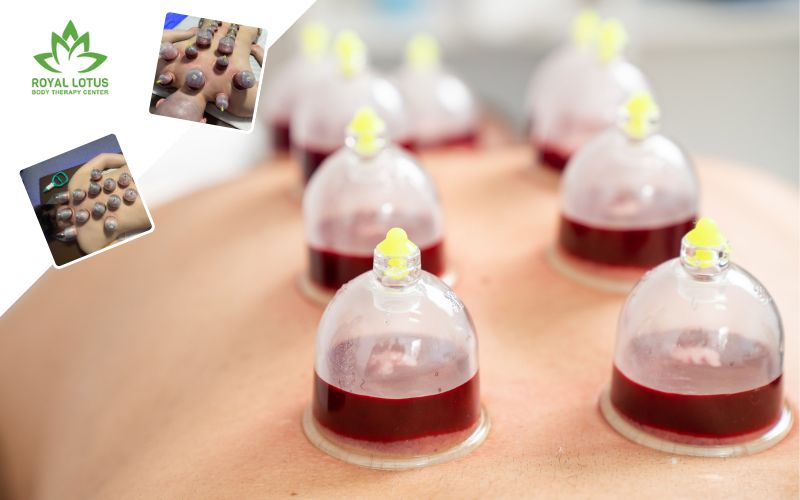 Odaberite tretman hidžame po TOP cijeni i riješite se nakupljenih toksina u organizmu u Royal Lotus Body Therapy Centru!